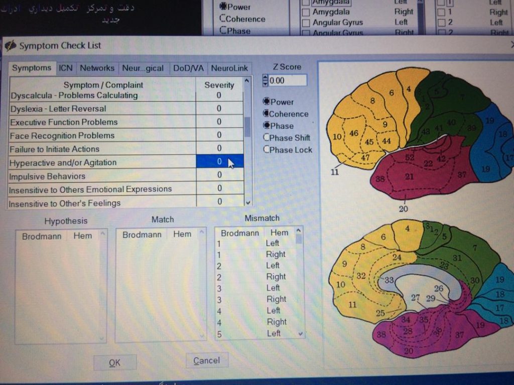 تاثیر نوروفیدبک بر اختلال نقص توجه و بیش فعالی