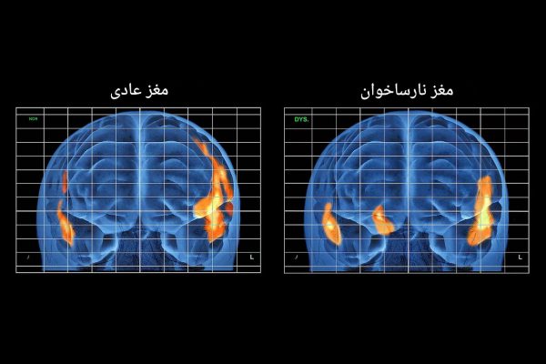 روش‌های تشخیص دیسلکسیا